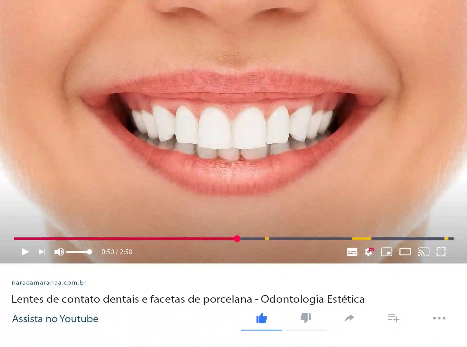 Procedimentos odontológicos estéticos • Dra. Nara Camarana